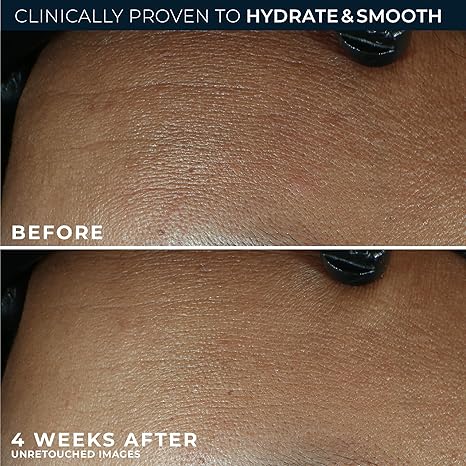 RoC Retinol Correxion Max Daily Hydration Anti-Aging Face Moisturizer with Hyaluronic Acid, Oil Free Skin Care Cream for Fine Lines, Dark Spots, Post-Acne Scars, 1.7 Ounces (Packaging May Vary) - Image 2